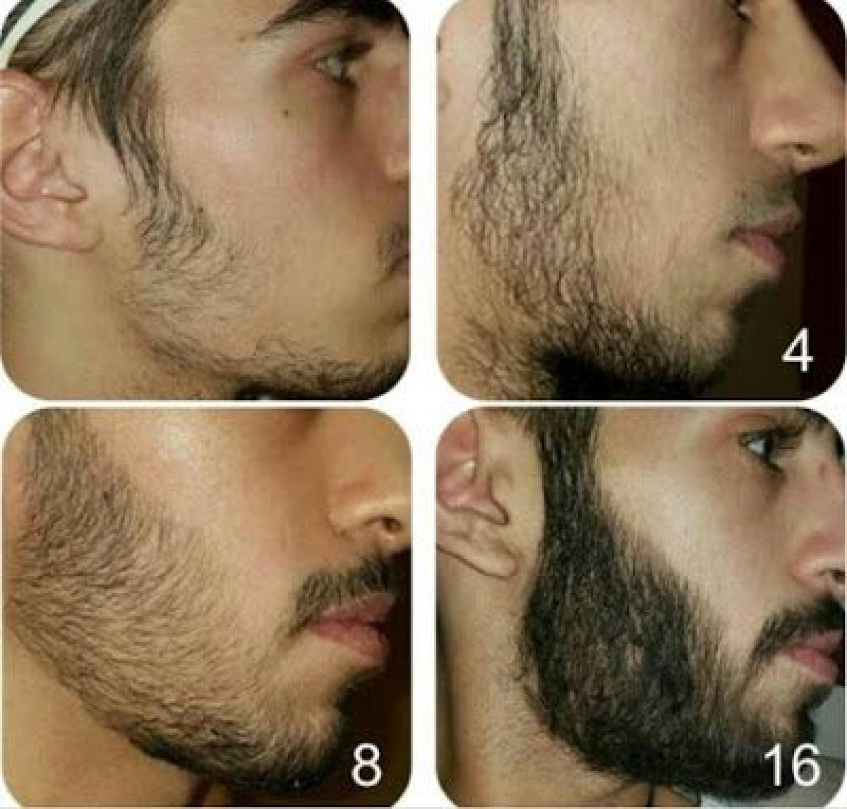 Aichun Beauty 100% Pure Natural Organic Beard Growth Oil — view 3