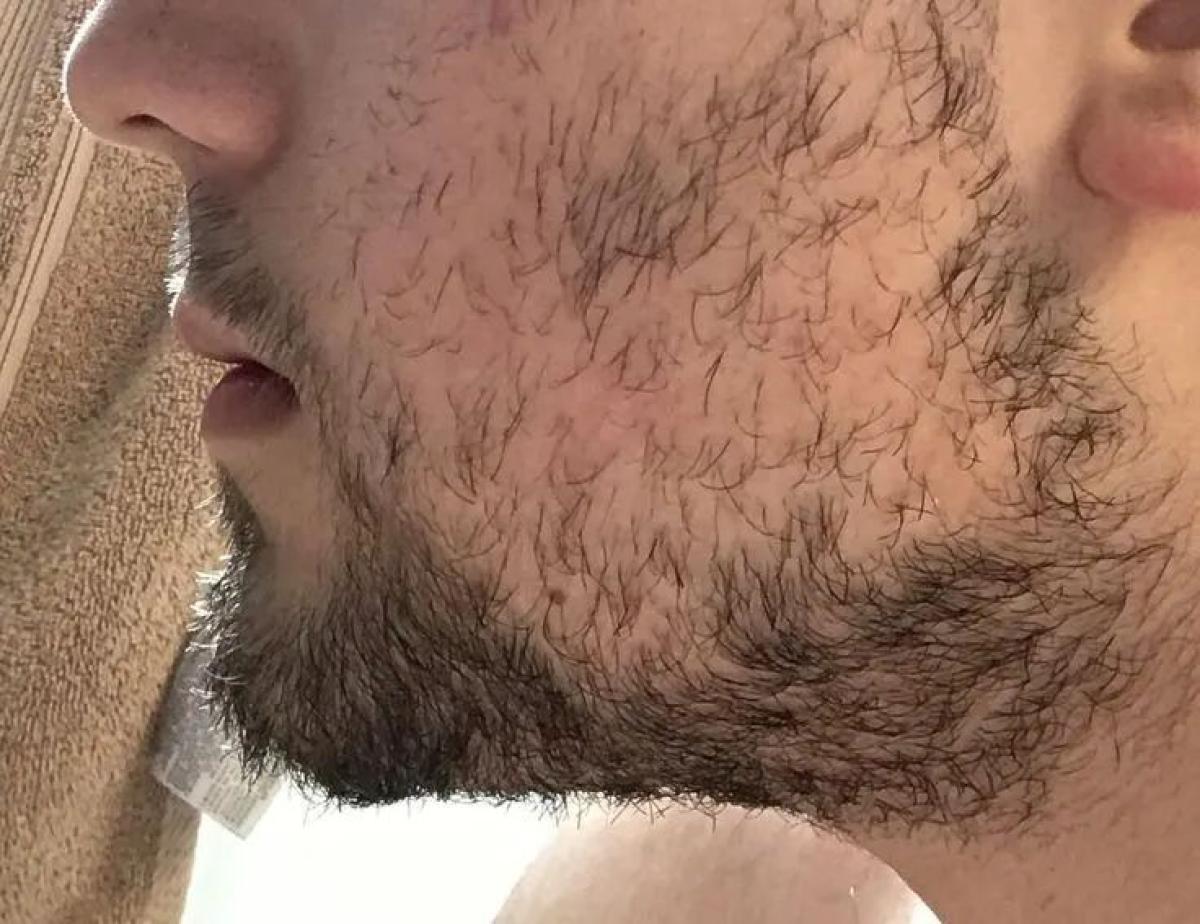 Aichun Beauty 100% Pure Natural Organic Beard Growth Oil — view 4